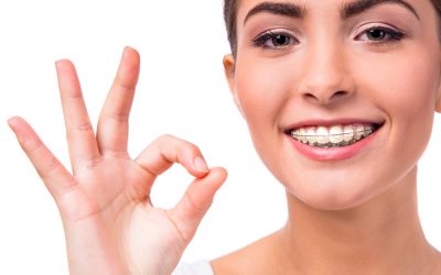 ¿Cuál es la duración de un tratamiento de ortodoncia?