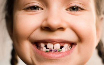 Preguntas frecuentes sobre ortodoncia infantil
